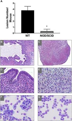 Unique Sensitivity of Uterine Tissue and the Immune System for Endometriotic Lesion Formation